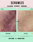 Clear Fight Serum