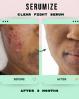 Clear Fight Serum