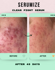 Clear Fight Serum