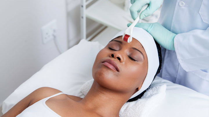 What Is Micro-needling
