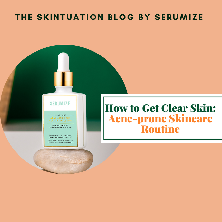 How to Get Clear Skin: Acne-prone Skincare Routine