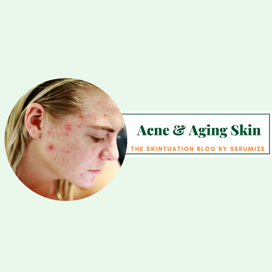 Acne & Aging Skin