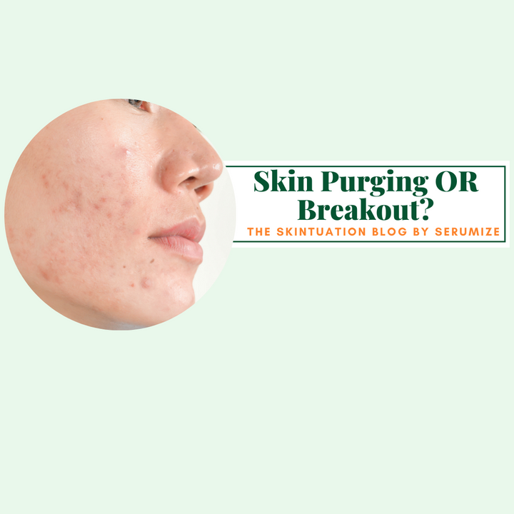 What Does Skin Purging Look Like? Skin Purging vs. Breakout