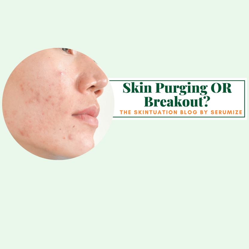 What Does Skin Purging Look Like? Skin Purging vs. Breakout SERUMIZE SKIN