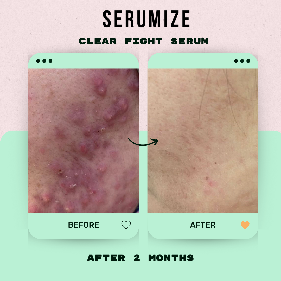 Clear Fight Serum