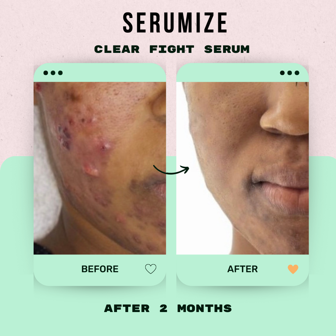 Clear Fight Serum