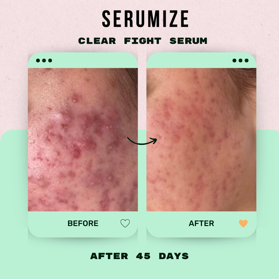 Clear Fight Serum